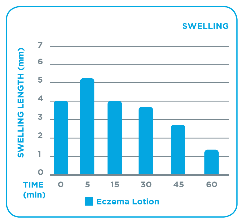 fl-ca_eczema-lotion_external_graphs_swelling-2