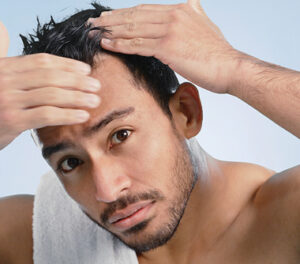 Scalp Care image