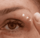 how to manage treat eczema around the eyes safely
